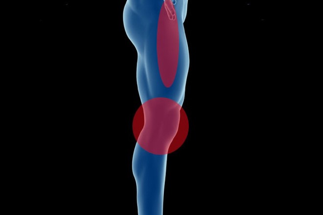 隐藏在膝盖周围的杀手——髂胫束综合征（ITBS）介绍与防治